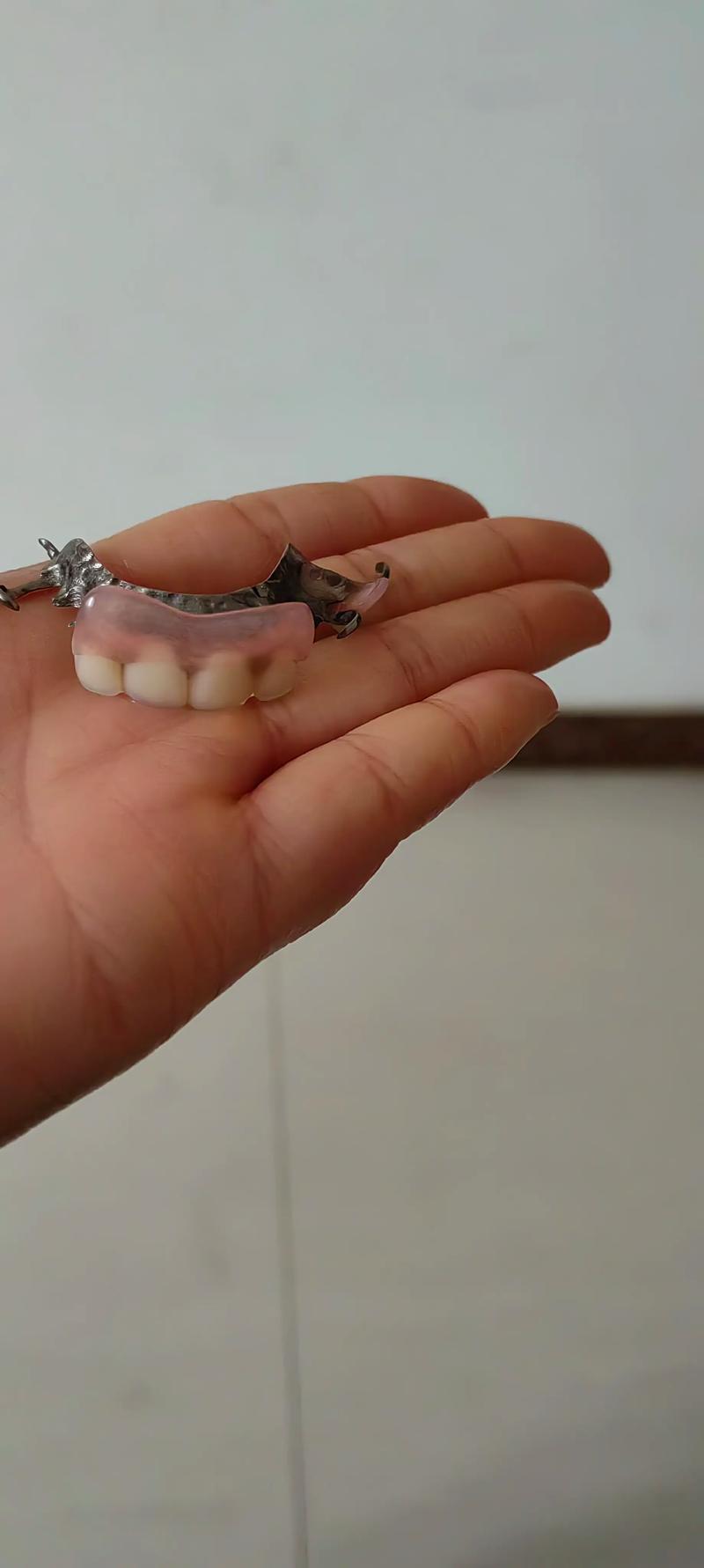 拔牙之后三个月种牙-图3