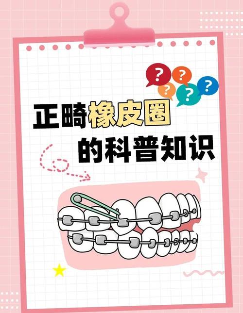 正畸橡皮圈一天带多久-图1