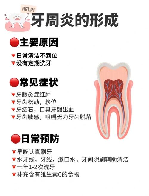 治疗牙周炎最有效方法-图3 治疗牙周炎最有效方法-图3