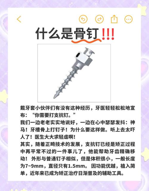 正畸二类牵引不打骨钉-图3