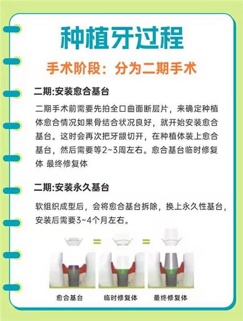 苏州牙博士种植牙方法具体有哪些，效果如何，有什么优势？-图1