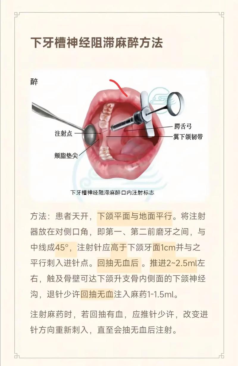 口腔阻滞麻醉常用方法有哪些？不同部位的麻醉技巧与注意事项是什么？-图1