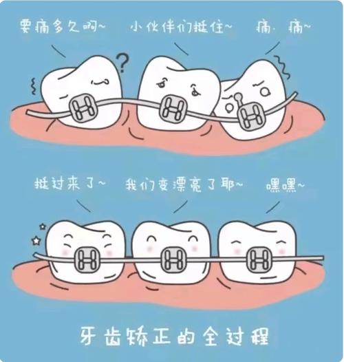 口腔正畸宣教动画图片-图1