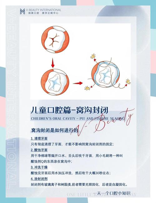 专业儿童口腔治疗方法-图1