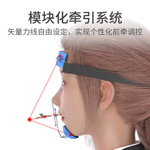 正畸前方牵引器多少钱-图2