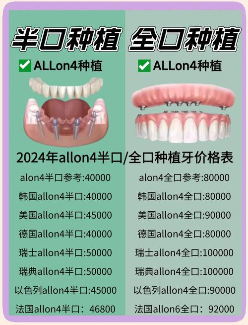 种牙种植多少钱一颗-图1 种牙种植多少钱一颗-图1