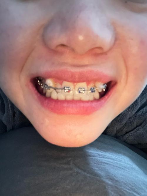 kq88口腔正畸图片-图2