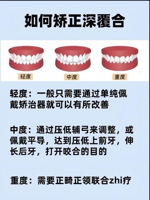牙齿深覆合矫正方法有哪些？如何选择适合自己的矫正方式？-图1