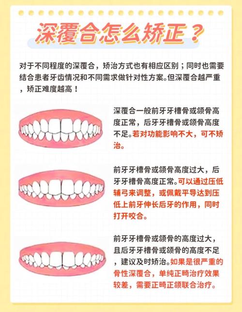 牙齿深覆合矫正方法有哪些？如何选择适合自己的矫正方式？-图3