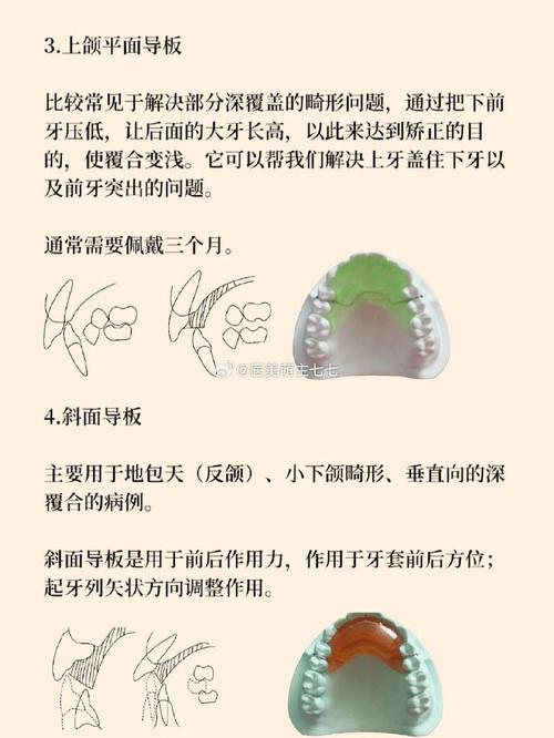 正畸矫治器的作用目的究竟是什么？-图1