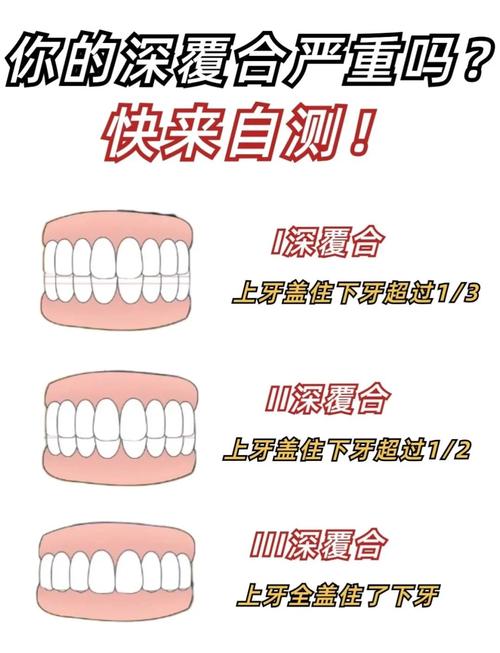 深覆合矫正有哪些方法？不同矫正方式有何区别？-图1