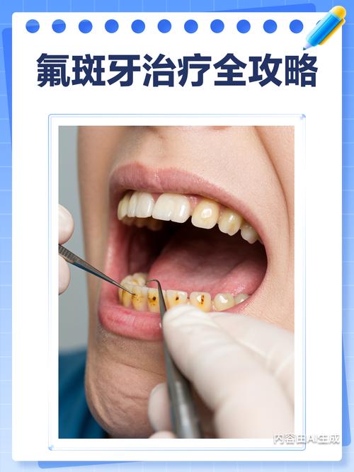 去除氟斑牙最好的方法-图3