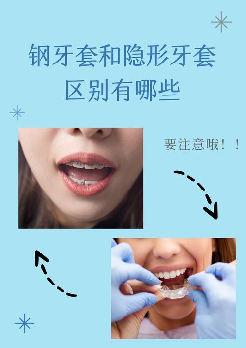 牙齿正畸治疗矫正过程中，是否所有人都必须佩戴牙套呢？-图1