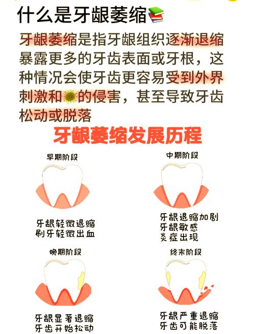 牙龈萎缩手术治疗方法-图1