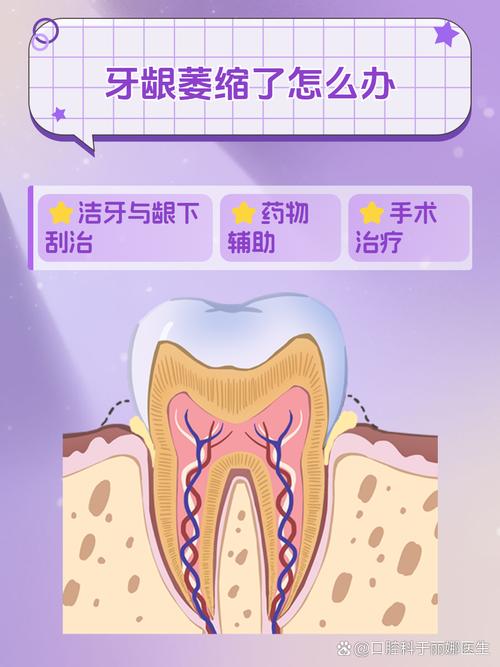 牙龈萎缩手术治疗方法-图2