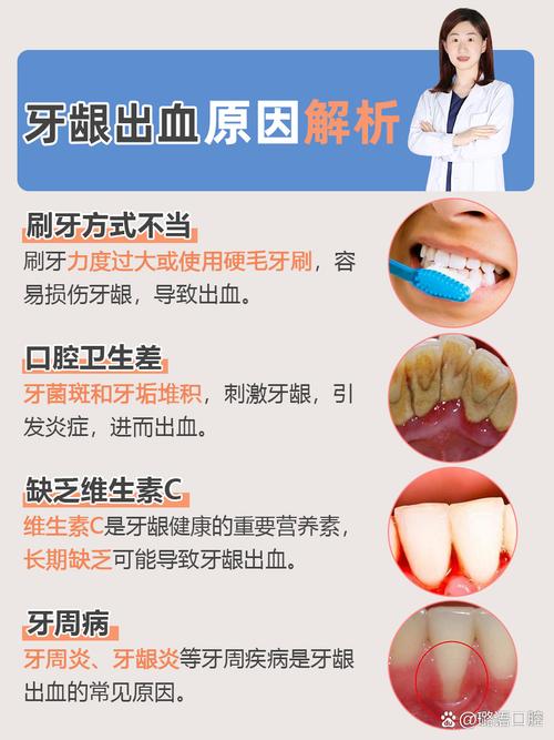 牙龈出血怎么治？专业治疗方法有哪些？-图2