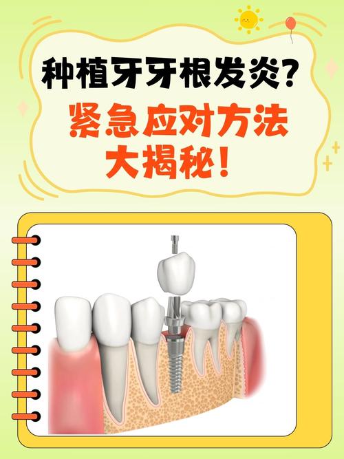 牙根发炎怎么办？治疗方法有哪些？-图1