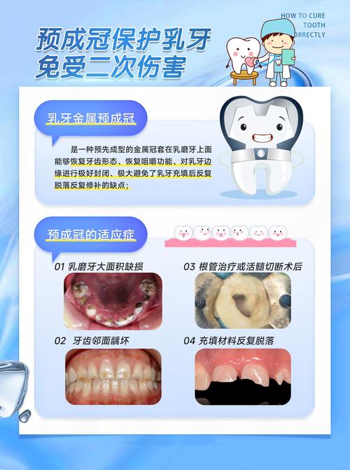 幼儿龋齿如何治疗方法-图1