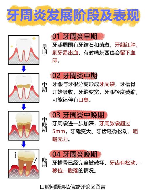 严重牙周炎的治疗方法-图1