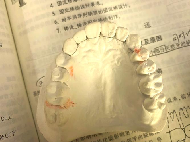 老人牙齿松动固定方法-图1