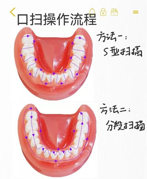 口腔脱敏治疗方法图解-图1