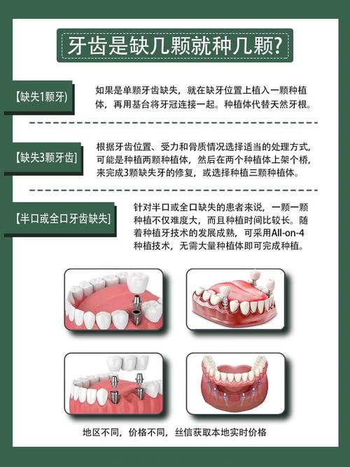 缺一颗牙需要种几颗-图1