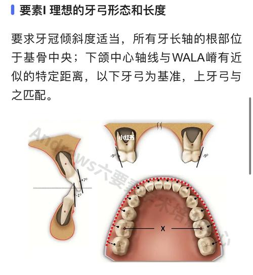 正畸软组织H线分析法在矫治中有何关键应用意义?-图3 正畸软组织H线分析法在矫治中有何关键应用意义?-图3