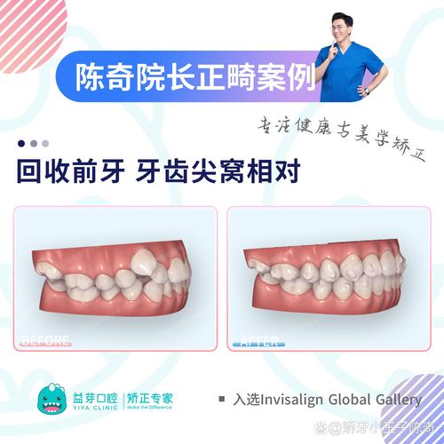 君臣贾豫文正畸怎么样-图2