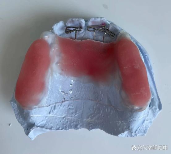 正畸双曲舌簧弯制方法-图1