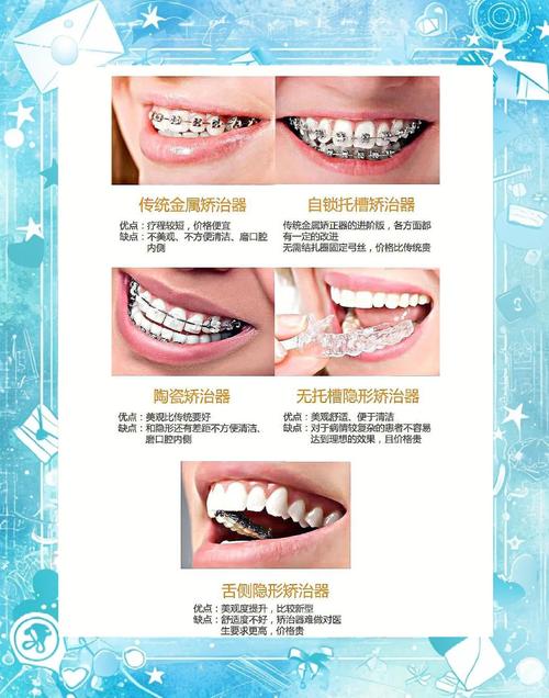 矫正器包含在正畸里吗-图3