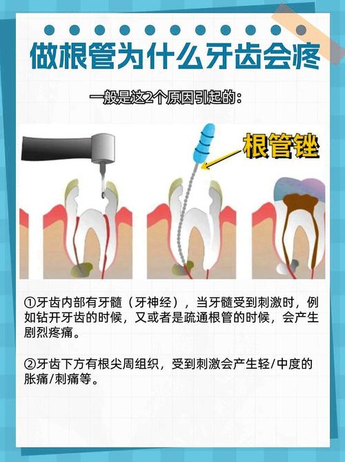 牙神经疼怎么治疗方法-图2