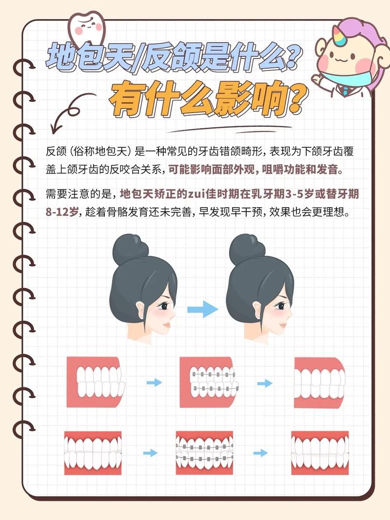 地包天矫正最快方法是什么？30天见效可行吗？-图1