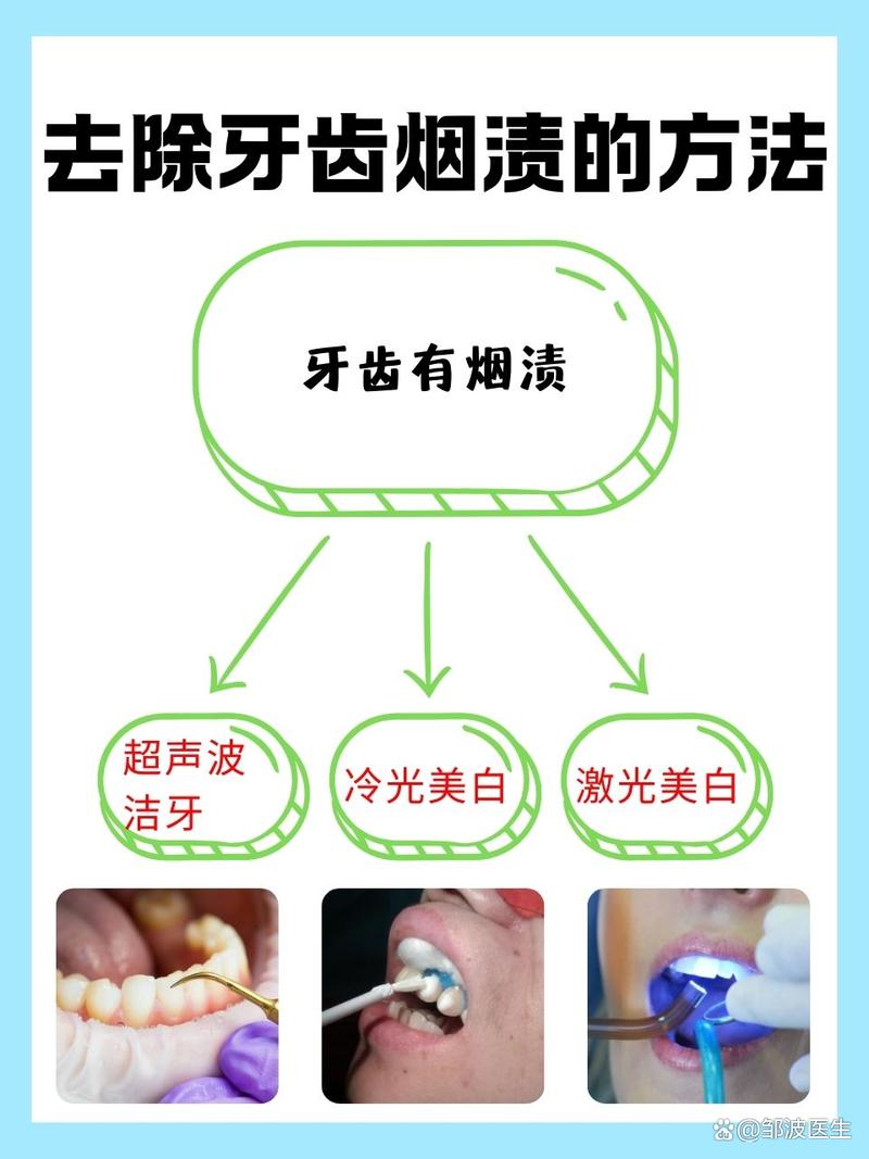 去除牙齿烟渍的好方法是什么？如何快速见效？-图2