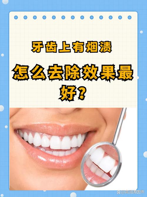 去除牙齿烟渍的好方法是什么？如何快速见效？-图3