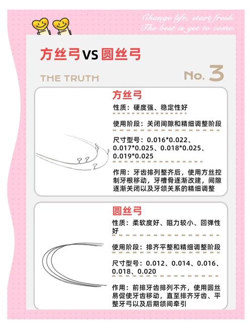 正畸方丝与直丝的区别是什么?核心差异及适用场景有何不同?-图1 正畸方丝与直丝的区别是什么?核心差异及适用场景有何不同?-图1