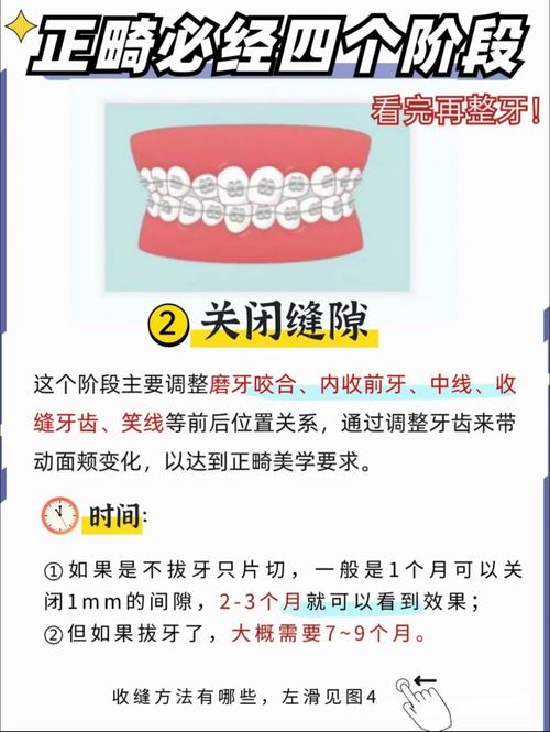 矫正牙齿有哪几种方法？各自有什么特点和适用范围？-图1