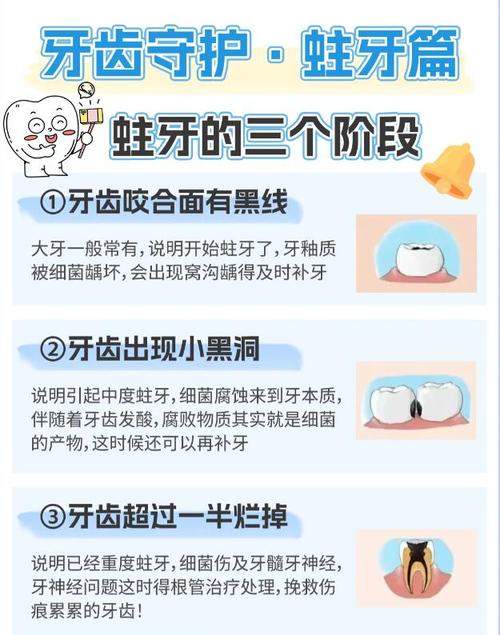 早期蛀牙有哪些治疗方法？如何有效控制病情发展？-图2