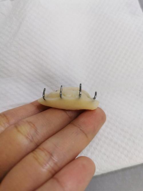 正畸树脂平导有什么用-图1