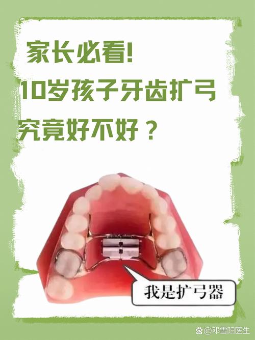 正畸磨牙远移要扩弓吗-图2