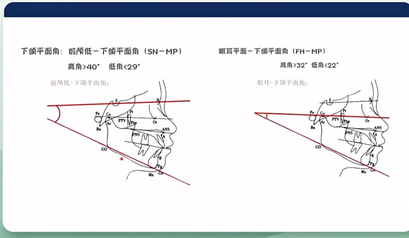 正畸中的高角和低角分别指什么？-图2
