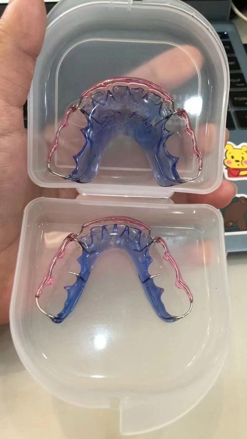 正畸后戴保持器一般要多少钱？-图2