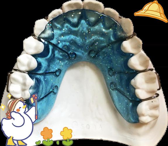 正畸后戴保持器一般要多少钱？-图1