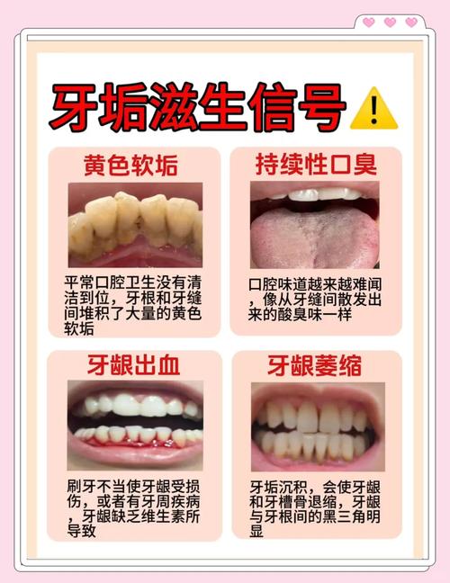 烟黄牙变白的简单方法-图3
