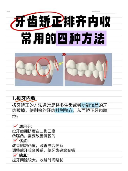 正畸能调整缺牙吗？缺牙患者可通过正畸治疗改善吗？-图2