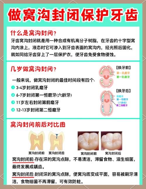 宝宝龋齿怎么治疗方法-图1