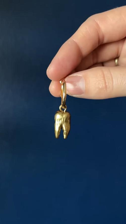 还有一种黄金叫牙金？它到底是什么来头？-图1