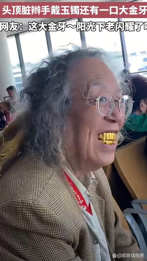 还有一种黄金叫牙金？它到底是什么来头？-图3