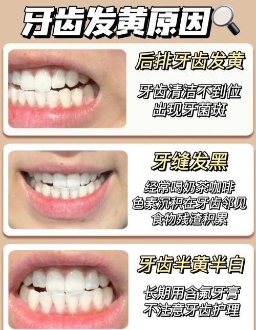 牙齿黄用什么方法美白-图1