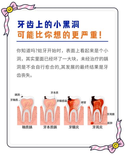 补牙的方法有几种类型-图1