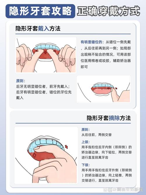 牙齿开合矫正最快方法是什么？如何才能让矫正时间最短且见效快？-图2